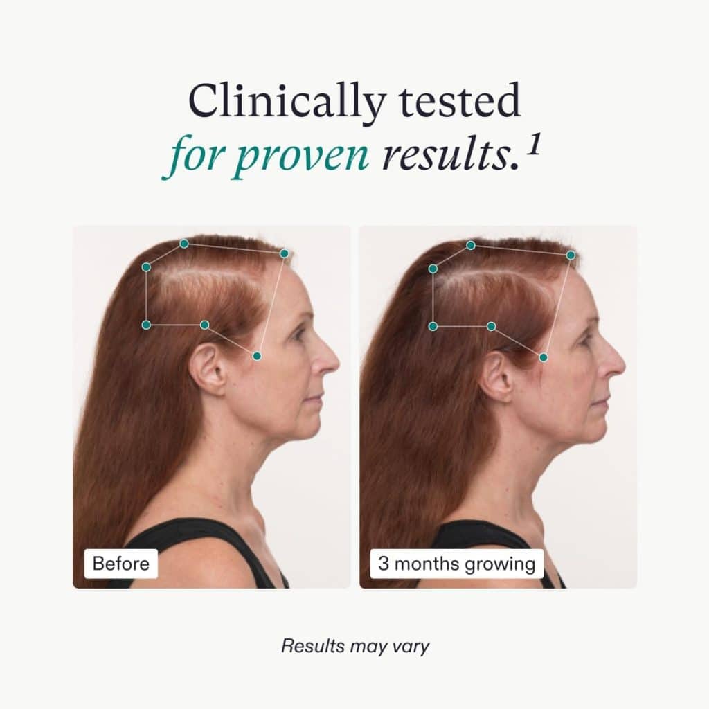 clinically proven results for nutrafol